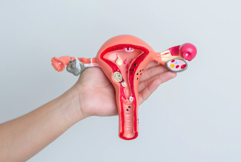 endometriosis surgery